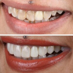 Asha-Roy-2-qea19eeruyqerp9vtuhs6st7rjqjhvkzx7r62aoyvc