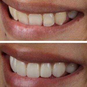 Deeksha-Joshi-3-1-qea1cei7owuduuwvan7vnjj82uxr32i4o2s0948ozs