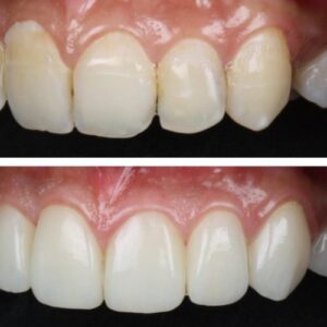 Deeksha-Joshi-6-1-qea1cfg1vqvo6gvi55mi81aoo8t4arlv07fhqe7atk