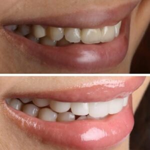 Hiral-5-r31i1wlfx2sbfmq9qmx4t5c0irg05aaxhsb89ht5zc