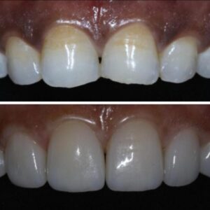 Mamta-3-qea1h4n01xba8a1qp6rcoulnlln6sa9jnguw478fpk